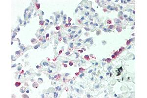 Anti-CYP2B6 antibody IHC staining of human lung. (CYP2B6 Antikörper  (AA 235-263))
