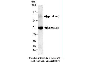 Image no. 1 for anti-Sema Domain, Immunoglobulin Domain (Ig), Short Basic Domain, Secreted, (Semaphorin) 3B (SEMA3B) (AA 100-200) antibody (ABIN363513) (SEMA3B Antikörper  (AA 100-200))