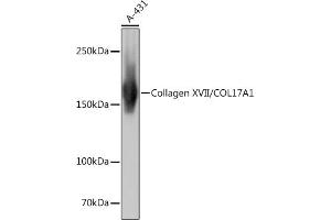 Western blot analysis of extracts of A-431 cells, using Collagen XVII/COL17 Rabbit mAb (ABIN7266467) at 1:1000 dilution. (COL17A1 Antikörper)