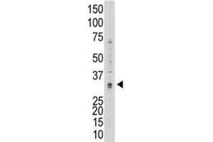 Western blot testing of MMP7 antibody and 293 cell lysate (MMP7 Antikörper  (AA 117-146))