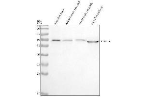 Western blot analysis of SHP2/PTPN11 using anti-SHP2/PTPN11 antibody (AZQ7ZW17).