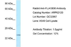 Western Blotting (WB) image for anti-Kazrin (KAZ) (C-Term) antibody (ABIN2774334) (Kazrin Antikörper  (C-Term))