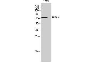 Western Blotting (WB) image for anti-Tripartite Motif Containing 38 (TRIM38) (Internal Region) antibody (ABIN3177285) (TRIM38 Antikörper  (Internal Region))