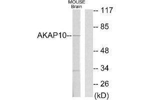 Western blot analysis of extracts from mouse brain cells, using AKAP10 antibody. (AKAP10 Antikörper  (N-Term))