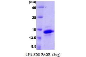 SDS-PAGE (SDS) image for Vesicle-Associated Membrane Protein 4 (VAMP4) (AA 1-115) protein (His tag) (ABIN666784)