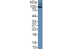 Western blot analysis of Human HL60 cell lysate, using Rabbit Anti-Human ICAM3 Antibody (1 µg/ml) and HRP-conjugated Goat Anti-Rabbit antibody (abx400043, 0. (ICAM-3/CD50 Antikörper  (AA 46-197))