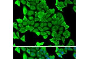 Immunofluorescence analysis of U2OS cells using MYH1 Polyclonal Antibody