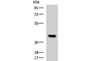 Western blot analysis of Human heart tissue lysate using FOXI1 Polyclonal Antibody at dilution of 1:800 (FOXI1 Antikörper)