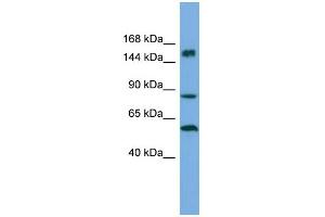 Host:  Rabbit  Target Name:  HERC3  Sample Type:  ACHN Whole Cell lysates  Antibody Dilution:  1. (HERC3 Antikörper  (Middle Region))