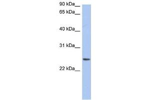 Neurensin 2 antibody used at 1 ug/ml to detect target protein. (NRSN2 Antikörper  (Middle Region))