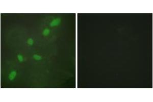 Immunofluorescence analysis of HeLa cells, using hnRNP A2/B1 Antibody. (HNRNPA2B1 Antikörper  (AA 1-50))