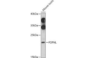Western blot analysis of extracts of Mouse testis, using FOPNL antibody (ABIN7267173) at 1:1000 dilution. (FOPNL Antikörper  (AA 20-100))