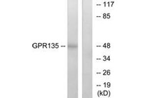 Western blot analysis of extracts from NIH-3T3 cells, using GPR135 Antibody. (GPR135 Antikörper  (AA 371-420))