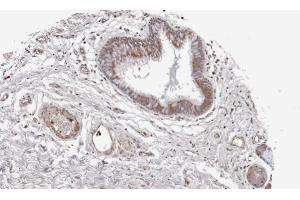 Immunohistochemistry (IHC) image for anti-Wingless-Type MMTV Integration Site Family, Member 11 (WNT11) (Center) antibody (ABIN2856232)