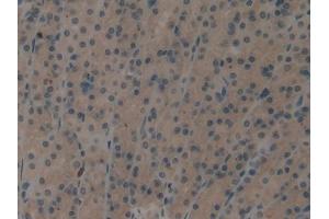DAB staining on IHC-P; Samples: Rat Stomach Tissue (EIF2AK2 Antikörper  (AA 279-506))