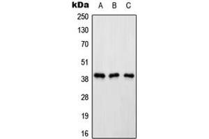 Western blot analysis of Renin Receptor expression in HeLa (A), Raw264. (ATP6AP2 Antikörper  (Center))