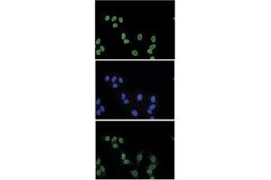 Immunofluorescent staining of mouse NIH3T3 cell line with antibody followed by an anti-rabbit antibody conjugated to Alexa488 (top).