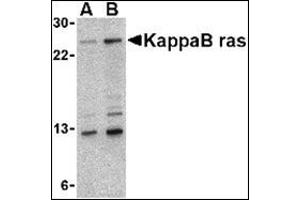 Western blot analysis of KappaB ras in 293 cell lysate with this product at (A) 2 and (B) 4 μg/ml. (NKIRAS1 Antikörper  (Center))