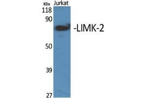 Western Blot (WB) analysis of specific cells using LIMK-2 Polyclonal Antibody. (LIMK2 Antikörper  (Internal Region))