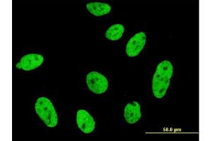Immunofluorescence of monoclonal antibody to CDKL1 on HeLa cell. (CDKL1 Antikörper  (AA 259-358))