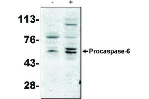 Western blot analysis using caspase-6 antibody on MCF-7 cells negative (-) and positive (+) for caspase-3 after treatment for 48 hours with thapsigargin. (Caspase 6 Antikörper)