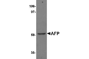 Western Blotting (WB) image for anti-alpha-Fetoprotein (AFP) (N-Term) antibody (ABIN1031219) (alpha Fetoprotein Antikörper  (N-Term))