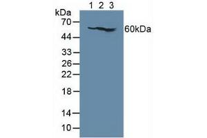 Figure. (IL7R Antikörper  (AA 173-260))