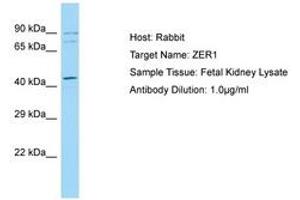 Image no. 1 for anti-Zyg-11 Related, Cell Cycle Regulator (ZER1) (C-Term) antibody (ABIN6749948) (ZER1 Antikörper  (C-Term))
