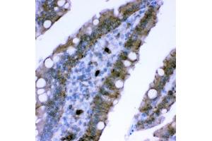 IHC analysis of Plectin using anti-Plectin antibody (ABIN3043900). (PLEC Antikörper  (Middle Region))