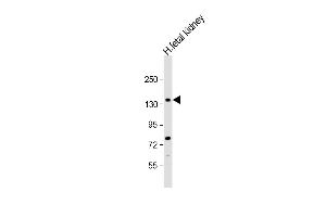 NEK1 Antikörper  (C-Term)