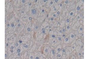 Detection of SDC1 in Human Liver Tissue using Polyclonal Antibody to Syndecan 1 (SDC1) (Syndecan 1 Antikörper  (AA 23-253))