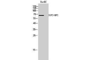 Western Blotting (WB) image for anti-Insulin-Like Growth Factor 2 mRNA Binding Protein 2 (IGF2BP2) (Internal Region) antibody (ABIN6280877)