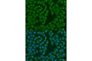 Immunofluorescence analysis of U2OS cells using MSRB3 antibody. (MSRB3 Antikörper  (AA 1-185))