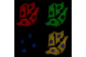 DDR1 Mouse Monoclonal Antibody staining HepG2 cells by IF/ICC. (DDR1 Antikörper  (C-Term))