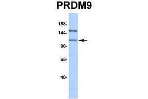Western Blotting (WB) image for anti-PR Domain Containing 9 (PRDM9) (Middle Region) antibody (ABIN2774963)