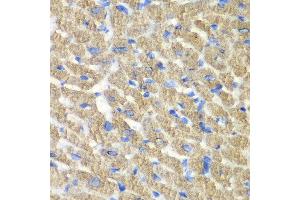 Immunohistochemistry of paraffin-embedded mouse heart using FIBP antibody at dilution of 1:100 (x40 lens).