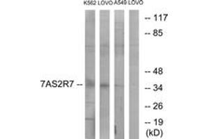 Western blot analysis of extracts from K562/LOVO/A549 cells, using TAS2R7 Antibody.