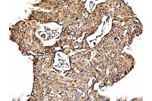 IHC analysis of TIMM29 using anti-TIMM29 antibody (ABIN7601495). (TIMM29 Antikörper  (AA 37-260))