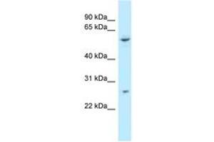 Image no. 1 for anti-Tetratricopeptide Repeat Domain 39B (TTC39B) (AA 378-427) antibody (ABIN6747851) (TTC39B Antikörper  (AA 378-427))