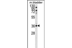 Western blot analysis of CCDC3 Antibody (C-term) (ABIN652692 and ABIN2842461) in mouse bladder tissue lysates (35 μg/lane). (CCDC3 Antikörper  (C-Term))