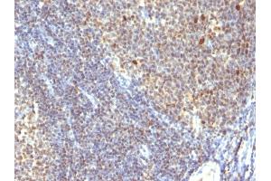Formalin-fixed, paraffin-embedded human Tonsil stained with IPO38 Monoclonal Antibody (SPM260). (Nuclear Antigen Antikörper)