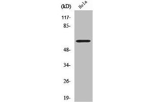 Western Blot analysis of LOVO cells using CYP2U1 Polyclonal Antibody (CYP2U1 Antikörper  (Internal Region))