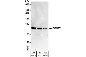 anti-TSPY-Like 2 (TSPYL2) (AA 643-693) antibody