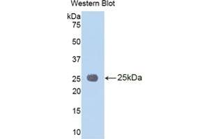 Detection of Recombinant IL1RAP, Human using Polyclonal Antibody to Interleukin 1 Receptor Accessory Protein (IL1RAP) (IL1RAP Antikörper  (AA 65-249))