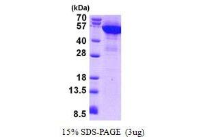 SDS-PAGE (SDS) image for Keratin 8 (KRT8) (AA 1-483) protein (His tag) (ABIN5852952) (KRT8 Protein (AA 1-483) (His tag))
