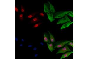 ABIN7094656 and ABIN7098707 staining  cells by IF/ICC.