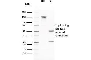 SDS-PAGE Analysis Purified RAD51 Mouse Monoclonal Antibody (RAD51/2765. (RAD51 Antikörper  (AA 1-134))