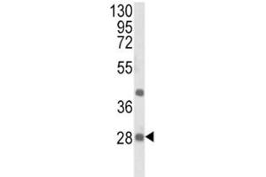 Western blot analysis of EIF4E2 antibody and NCI-H460 lysate. (EIF4E2 Antikörper)