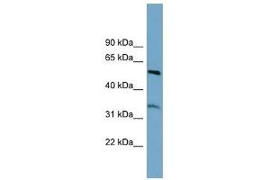 THNSL2 antibody used at 1 ug/ml to detect target protein. (THNSL2 Antikörper)