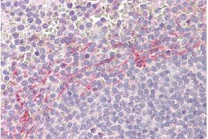 Immunohistochemistry (IHC) image for anti-Apolipoprotein B mRNA Editing Enzyme, Catalytic Polypeptide-Like 3D (APOBEC3D) (AA 61-74) antibody (ABIN5539684)